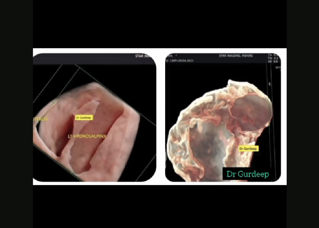 Advanced Gynecological Ultrasound